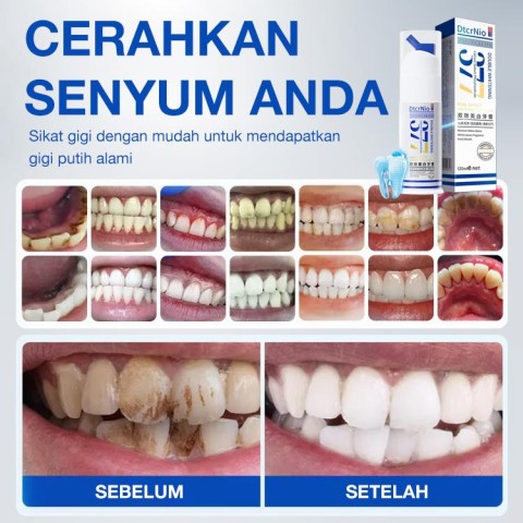 Pasta Gigi 377 Whitening Dual Effect