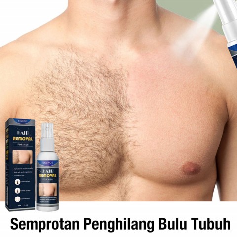 Losion penghilang bulu badan