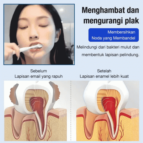 Agen Pemisah Gigi