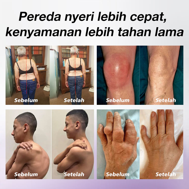 Promosi Idul Adha-Gel Pijat Pereda Sakit yang Menenangkan - Sempurna untuk nyeri sendi/nyeri otot/tenosinovitis/kesemutan pada jari!